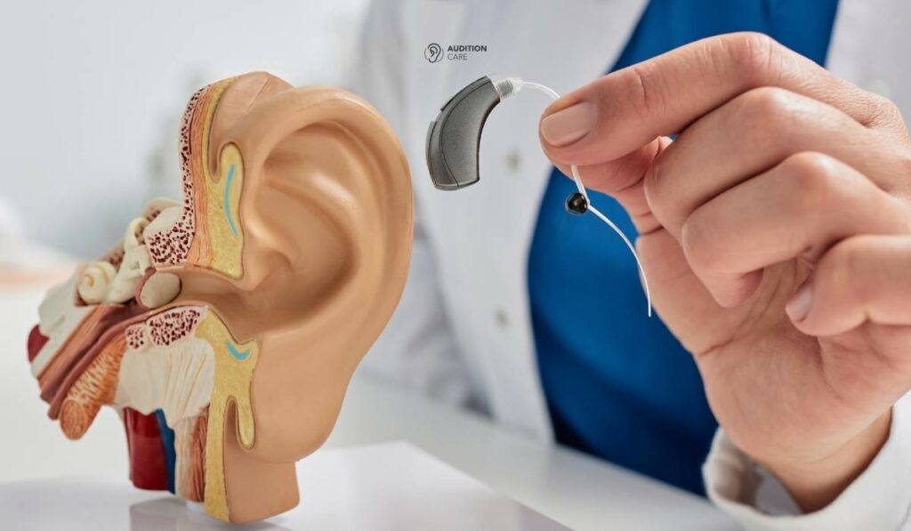 Reste à charge des appareils auditifs